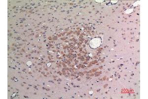 Immunohistochemistry (IHC) analysis of paraffin-embedded Rat Brain, antibody was diluted at 1:100. (FGF9 antibody  (C-Term))