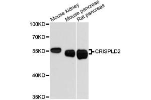 Western blot analysis of extracts of various cell lines, using CRISPLD2 antibody (ABIN6291926) at 1:3000 dilution. (CRISPLD2 antibody)