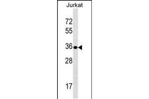 Western blot analysis in Jurkat cell line lysates (35ug/lane). (Uroplakin 3B antibody  (AA 192-219))