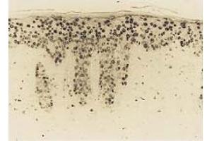 Immunohistochemistry (IHC) image for anti-8-Hydroxyguanosine (8-OHDG) antibody (ABIN492633) (8-OHDG antibody)