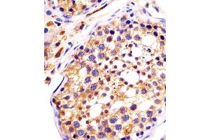 (ABIN6242987 and ABIN6578147) staining DYNC1H1 in human testis sections by Immunohistochemistry (IHC-P - paraformaldehyde-fixed, paraffin-embedded sections). (DYNC1H1 antibody  (C-Term))