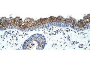 Human Skin (ZNF397 antibody  (C-Term))