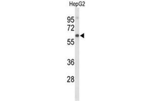 Western blot analysis of AFM Antibody (N-term) in HepG2 cell line lysates (35µg/lane). (Afamin antibody  (N-Term))