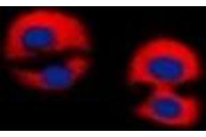 Immunofluorescent analysis of Dematin staining in Jurkat cells. (Dematin antibody  (C-Term))