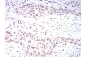 Immunohistochemistry (IHC) image for anti-DNA (Cytosine-5-)-Methyltransferase 3 beta (DNMT3B) (AA 1-150) antibody (ABIN5542518)