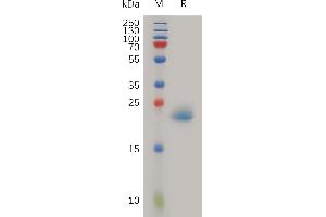 Peptidoglycan Recognition Protein 1 (PGLYRP1) (AA 22-196) protein (His tag)