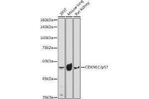 Western blot analysis of extracts of various cell lines, using CDKN1C/p57 Kip2 antibody (ABIN3022818, ABIN3022819, ABIN3022820, ABIN1512749 and ABIN6219243) at 1:1000 dilution. (CDKN1C antibody  (AA 1-100))
