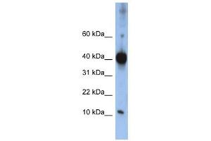 LSM4 antibody used at 1 ug/ml to detect target protein. (LSM4 antibody)