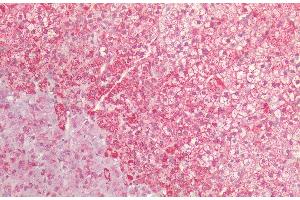 Immunohistochemistry analysis using Rabbit Anti-HSP60 Polyclonal Antibody (ABIN2486158). (HSPD1 antibody  (Biotin))