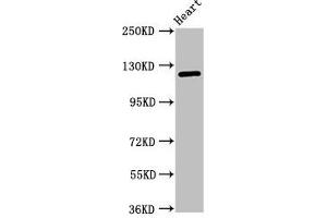 Western Blot Positive WB detected in: Mouse heart tissue All lanes: SEMA5B antibody at 1 μg/mL Secondary Goat polyclonal to rabbit IgG at 1/50000 dilution Predicted band size: 126, 120, 124, 132 kDa Observed band size: 126 kDa (SEMA5B antibody  (AA 845-1013))