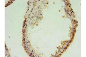 Immunohistochemistry of paraffin-embedded human testis tissue using ABIN7159148 at dilution of 1:100 (MED28 antibody  (AA 1-178))