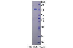 SDS-PAGE analysis of Human TTF1 Protein. (TTF1 Protein)