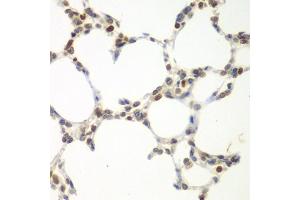 Immunohistochemistry of paraffin-embedded mouse lung using VRK1 antibody (ABIN5975628) at dilution of 1/100 (40x lens). (VRK1 antibody)