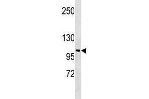 LOXL2 antibody western blot analysis in A549 lysate. (LOXL2 antibody  (AA 589-617))