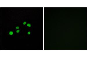 Immunofluorescence analysis of HepG2 cells, using Collagen XXIII α1 antibody.