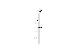 Anti-ARPC1A Antibody (C-term) at 1:1000 dilution + Hela whole cell lysate Lysates/proteins at 20 μg per lane. (ARPC1A antibody  (C-Term))