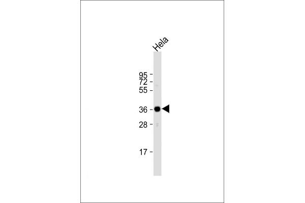 ARPC1A antibody  (C-Term)