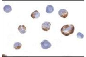 Immunocytochemistry of PAK5 in K562 cells with this product at 2 μg/ml. (PAK7 antibody  (Center))