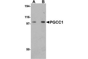 Western Blotting (WB) image for anti-Family with Sequence Similarity 120B (FAM120B) (C-Term) antibody (ABIN1030576) (FAM120B antibody  (C-Term))