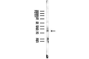 Western blot analysis of lysates from Rat liver, using SCAMP1 Antibody at 1/1000 dilution.