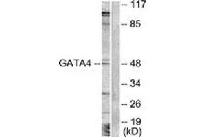 Western blot analysis of extracts from COLO205 cells, treated with Serum 20% 15', using GATA4 (Ab-262) Antibody. (GATA4 antibody  (AA 228-277))