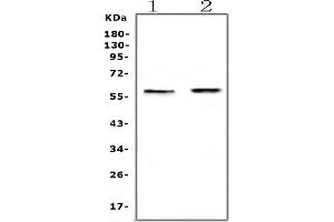 Western blot analysis of ETV6/Tel using anti-ETV6/Tel antibody (ABIN5693220).
