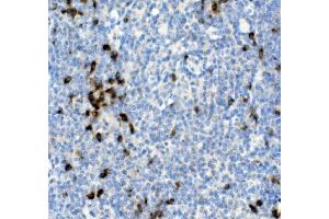 IHC analysis of Cd79a using anti-Cd79a antibody (ABIN7601110). (CD79a antibody  (AA 29-220))