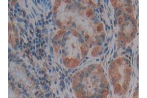 Used in DAB staining on fromalin fixed paraffin- embedded liver tissue (Thrombospondin 1 antibody  (AA 24-221))