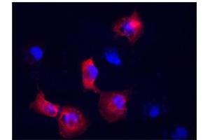 submitted by:Carl LundinStanford UniversityThe Vimentin antibody  works well for visualization of the vimentin cytoskeleton (see attached images). (Vimentin antibody  (N-Term))