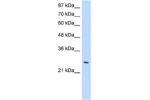 WB Suggested Anti-ZNF575 Antibody Titration:  1. (ZNF575 antibody  (C-Term))