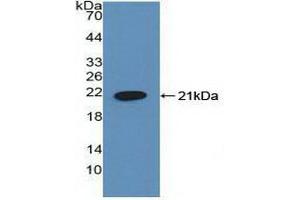 Detection of Recombinant HLTF, Human using Polyclonal Antibody to Helicase Like Transcription Factor (HLTF) (HLTF antibody  (AA 837-996))