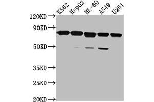 Western Blot Positive WB detected in: K562 whole cell lysate, HepG2 whole cell lysate, HL-60 whole cell lysate, A549 whole cell lysate, U251 whole cell lysate All lanes: TMEM214 antibody at 1:2000 Secondary Goat polyclonal to rabbit IgG at 1/50000 dilution Predicted band size: 78, 73 kDa Observed band size: 78 kDa (TMEM214 antibody  (AA 2-236))