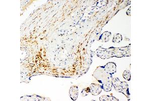 Anti-SLC16A4 antibody, IHC(P) IHC(P): Human Placenta Cancer Tissue (SLC16A4 antibody  (N-Term))