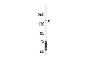 NOS2A Antibody (Center) (ABIN655717 and ABIN2845167) western blot analysis in CEM cell line lysates (35 μg/lane).