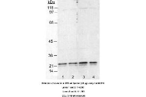 Image no. 2 for anti-Caveolin 1, Caveolae Protein, 22kDa (CAV1) antibody (ABIN363230) (Caveolin-1 antibody)