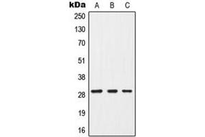 Western blot analysis of G18 expression in MCF7 (A), mouse brain (B), PC12 (C) whole cell lysates. (GPSM3 antibody  (Center))