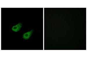 Immunofluorescence analysis of HeLa cells, using JIP3 antibody. (JIP3 antibody  (Internal Region))