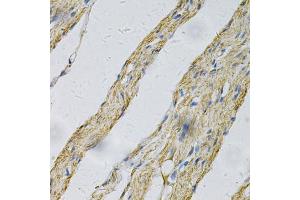 Immunohistochemistry of paraffin-embedded human smooth muscle using PRNP Antibody (ABIN5971407) at dilution of 1/100 (40x lens). (PRNP antibody)