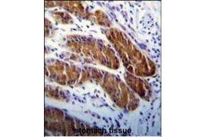 ATG5 Antibody (ABIN650657 and ABIN2849633) immunohistochemistry analysis in formalin fixed and paraffin embedded human stomach tissue followed by peroxidase conjugation of the secondary antibody and DAB staining. (ATG5 antibody)
