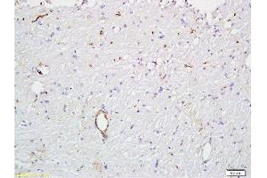 Formalin-fixed and paraffin embedded rat brain tissue  at 1:300 followed by conjugation to the secondary antibody and DAB staining. (VWF antibody  (AA 701-800))