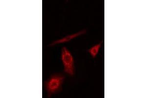 ABIN6274186 staining A549 cells by IF/ICC. (PFKL antibody  (C-Term))