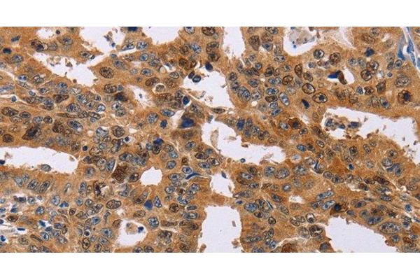 NIF3L1 antibody