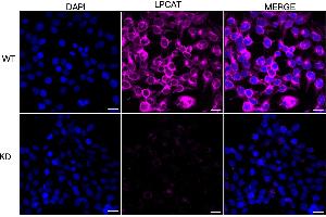 anti-Lysophosphatidylcholine Acyltransferase 1 (LPCAT1) antibody