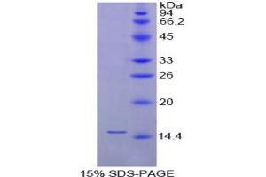 SDS-PAGE analysis of Chicken FABP1 Protein.