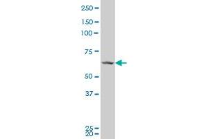 PRPF31 polyclonal antibody (A01), Lot # 060619JCS1 Western Blot analysis of PRPF31 expression in HeLa . (PRPF31 antibody  (AA 400-499))
