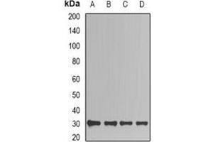 Western blot analysis of TIM expression in Jurkat (A), HepG2 (B), mouse kidney (C), mouse brain (D) whole cell lysates. (TPI1 antibody)