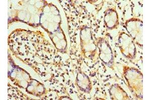 Immunohistochemistry of paraffin-embedded human small intestine tissue using ABIN7170334 at dilution of 1:100 (SRI antibody  (AA 1-198))
