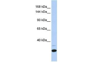 WB Suggested Anti-ZNF197 Antibody Titration:  0. (ZNF197 antibody  (N-Term))