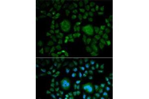 Immunofluorescence analysis of HeLa cells using CA2 Polyclonal Antibody (CA2 antibody)