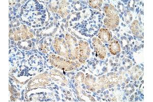FZD7 antibody was used for immunohistochemistry at a concentration of 4-8 ug/ml to stain Epithelial cells of renal tubule (arrows) in Human Kidney. (FZD7 antibody)